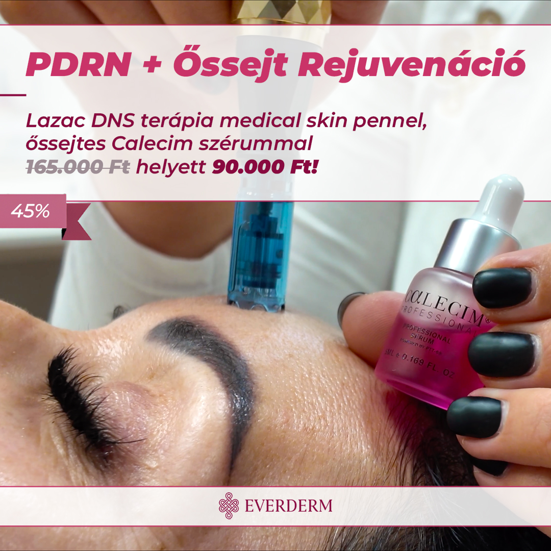 pdrn-calecim_1080