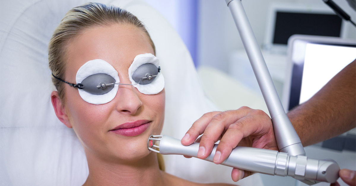 frakcionált lézeres bőrmegújítás